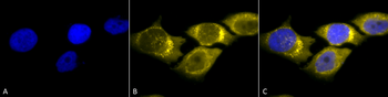 SOD2 (Mn) Antibody (RPE)