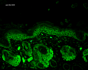 SOD2 (Mn) Antibody (RPE)