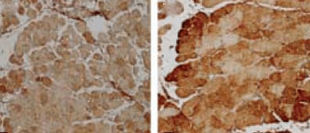 SOD2 (Mn) Antibody (RPE)