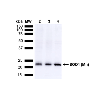SOD2 (Mn) Antibody (RPE)
