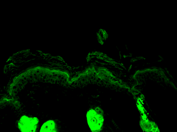 Calreticulin Antibody (APC)