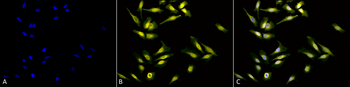 Calreticulin Antibody (APC)