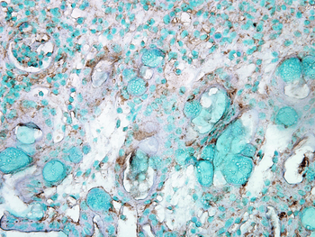 HSP70 Antibody (PerCP)