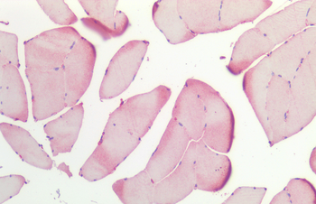HSP27 Antibody (PerCP)