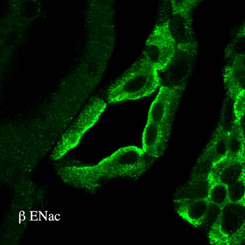 ENaC beta Antibody (RPE)