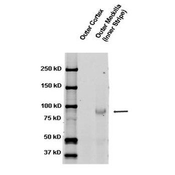 ENaC beta Antibody (RPE)