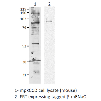 ENaC beta Antibody (RPE)