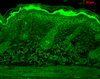 Calnexin-CT Antibody (HRP)