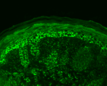 Cpn10 Antibody (APC)
