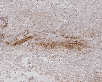 Alginate Antibody (Biotin)