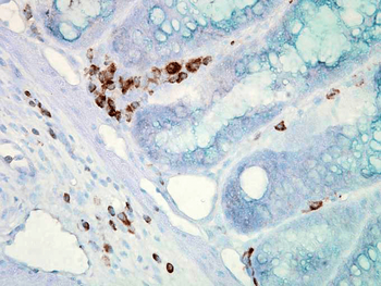 HSP70 Antibody (FITC)