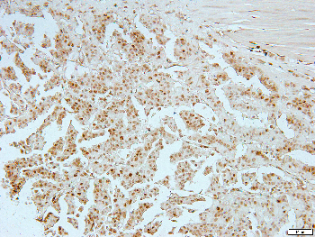 Histone H4 (Acetyl-K8) Rabbit Polyclonal Antibody