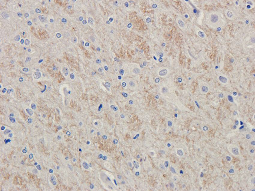 LHCGR Rabbit Polyclonal Antibody