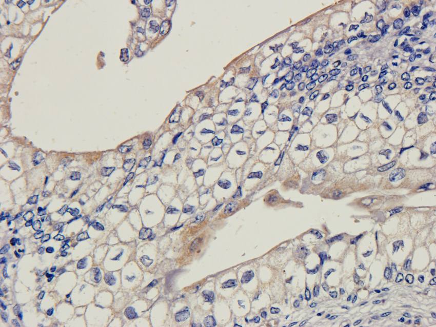 LHCGR Rabbit Polyclonal Antibody