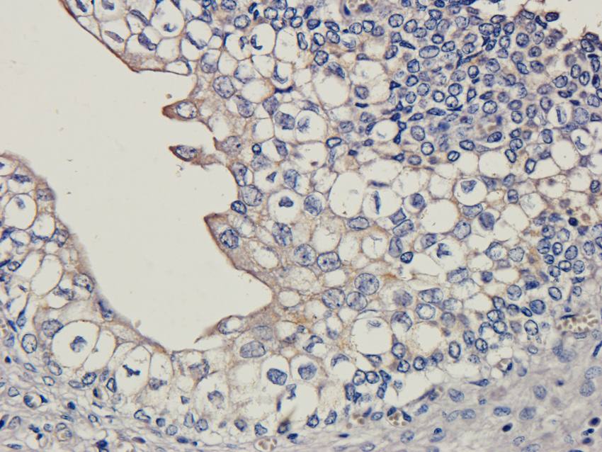 LHCGR Rabbit Polyclonal Antibody