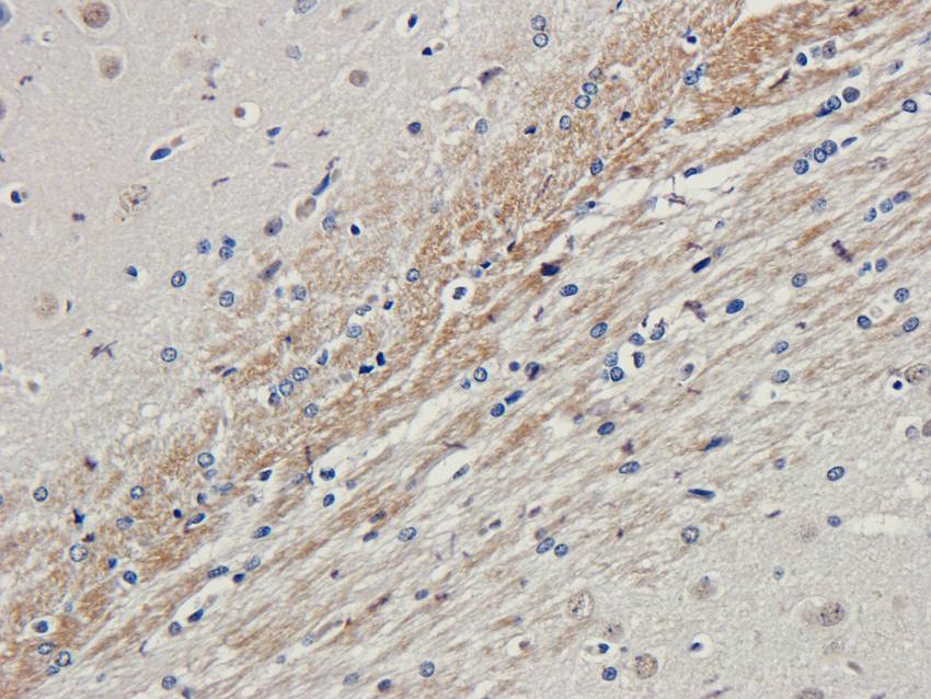 LHCGR Rabbit Polyclonal Antibody