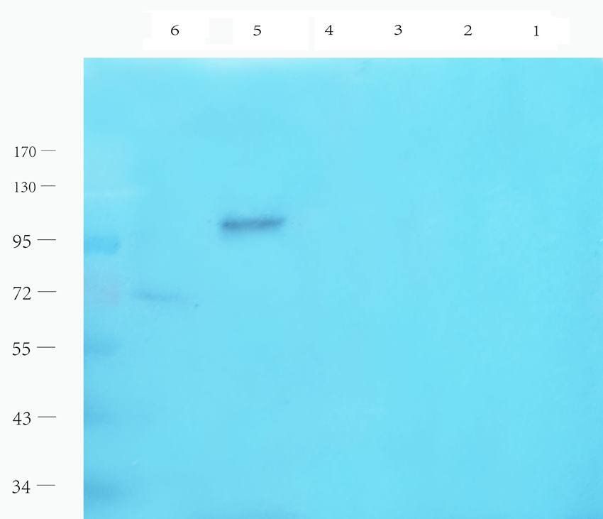 LHCGR Rabbit Polyclonal Antibody