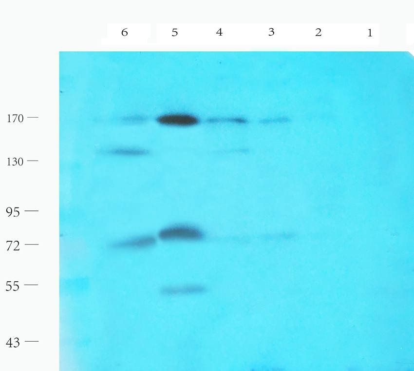 LHCGR Rabbit Polyclonal Antibody