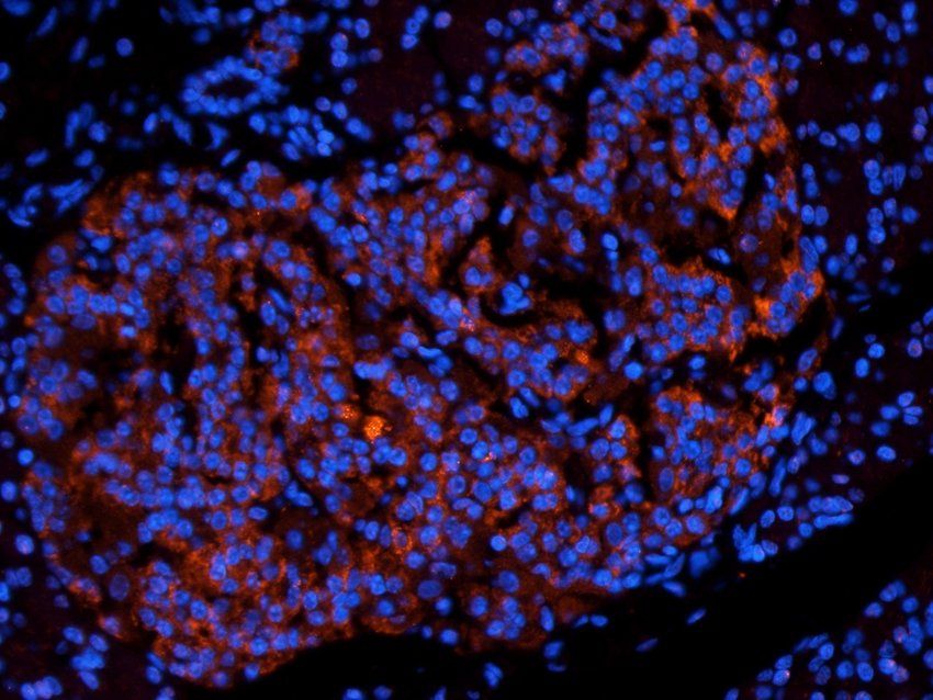 CD38 Rabbit Polyclonal Antibody