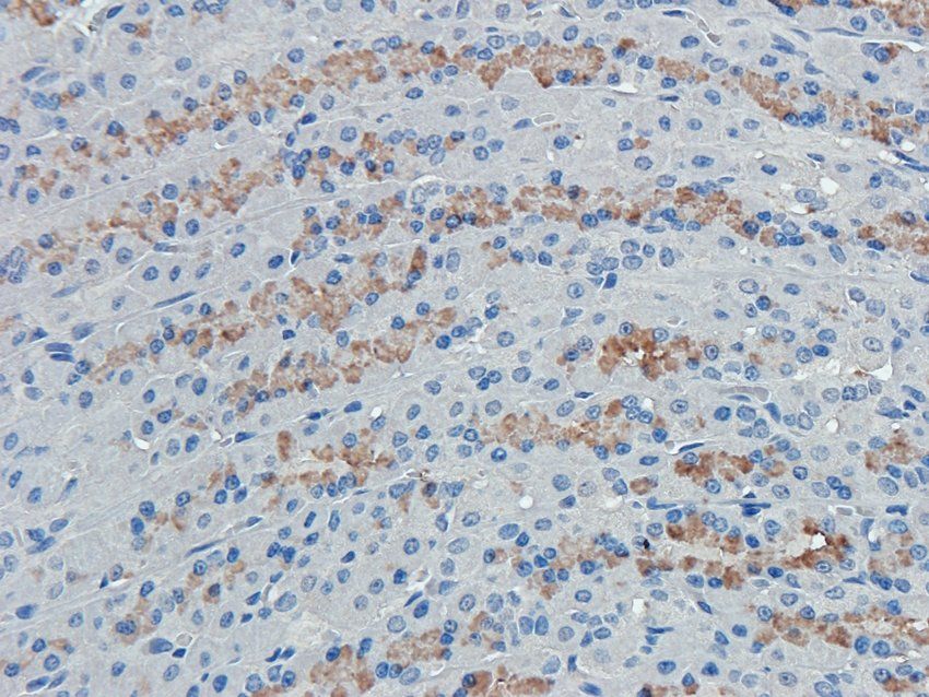 CD38 Rabbit Polyclonal Antibody