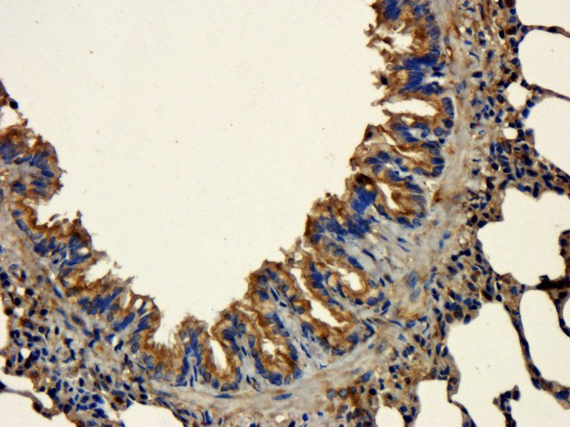 CD44 Rabbit Polyclonal Antibody