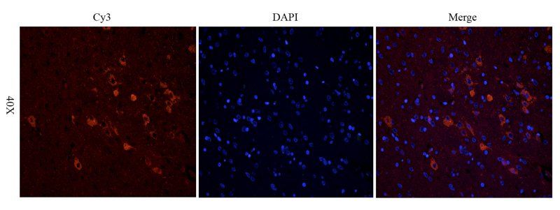 CHRNA7 Rabbit Polyclonal Antibody
