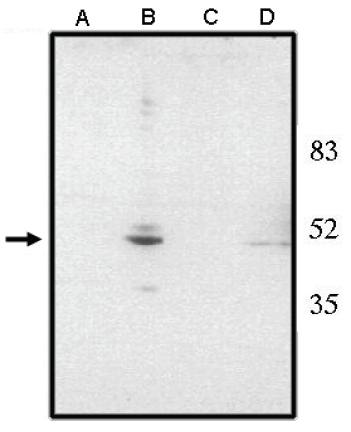 Sheep Human chx 10 (Visual system homeobox 2) (NT) Antibody