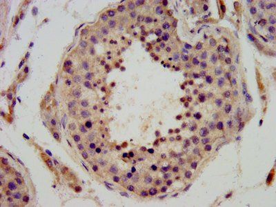 DPPA3 Antibody