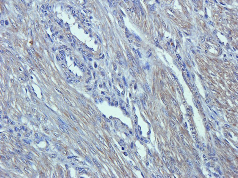 Emp1 Rabbit Polyclonal Antibody