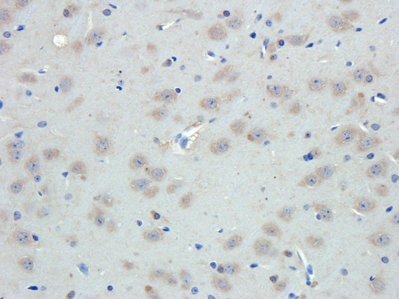 Emp1 Rabbit Polyclonal Antibody