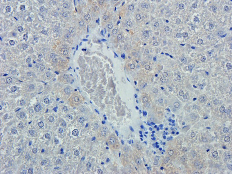 Emp1 Rabbit Polyclonal Antibody