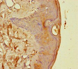 EPS8L2 Antibody