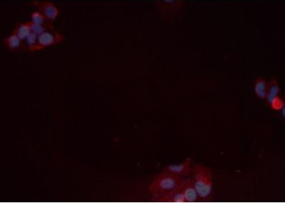Phospho-pan-AKT1/2/3 (Ser473) Antibody