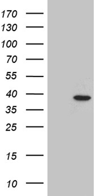 GCM1 Antibody