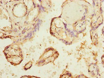 GCM1 Antibody