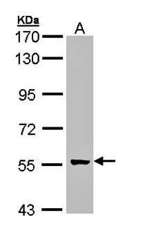glial cells missing homolog 2 antibody