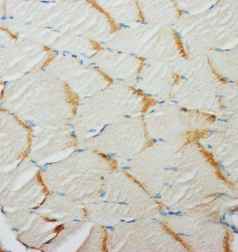 Glucose Transporter GLUT4/SLC2A4 Rabbit Polyclonal Antibody