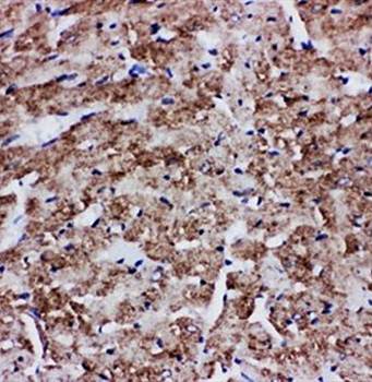 Glucose Transporter GLUT4/SLC2A4 Rabbit Polyclonal Antibody