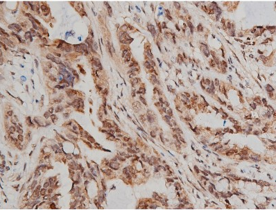 Phospho-pan-AKT1/2/3 (Ser473) Antibody