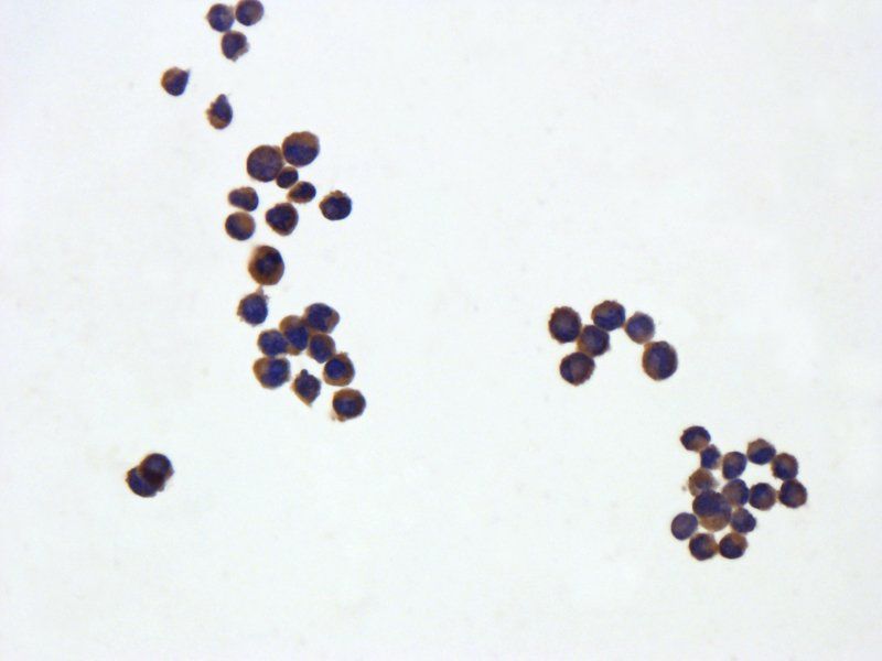 IL6 Rabbit Polyclonal Antibody