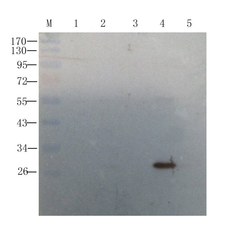 IL6 Rabbit Polyclonal Antibody