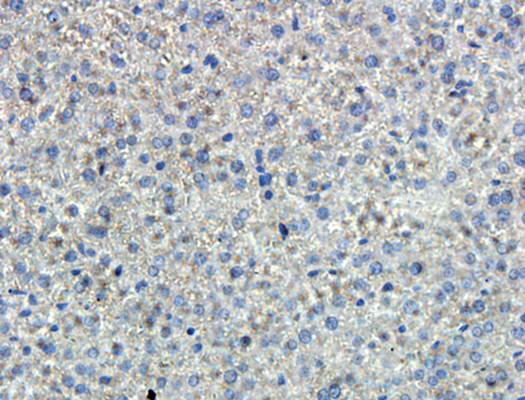 IL6 Rabbit Polyclonal Antibody