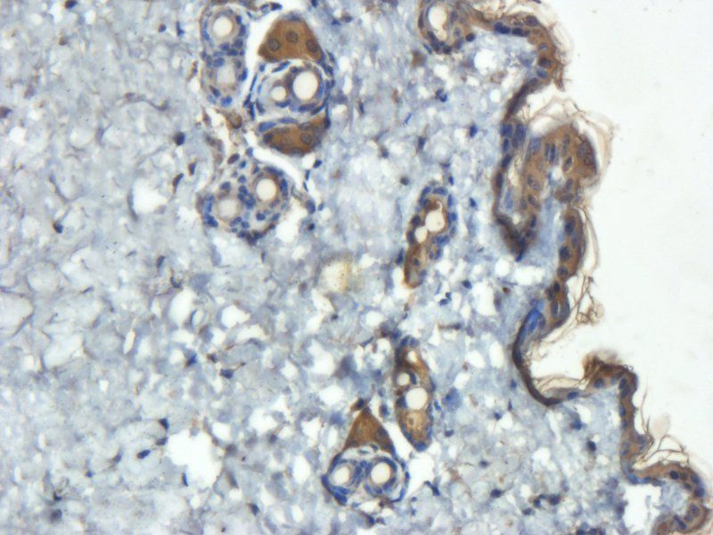 IL6 Rabbit Polyclonal Antibody