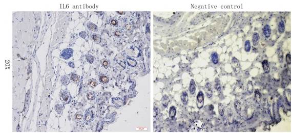 IL6 Rabbit Polyclonal Antibody