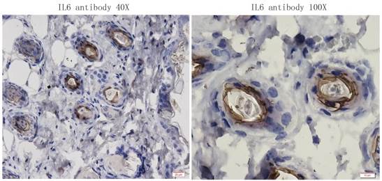 IL6 Rabbit Polyclonal Antibody