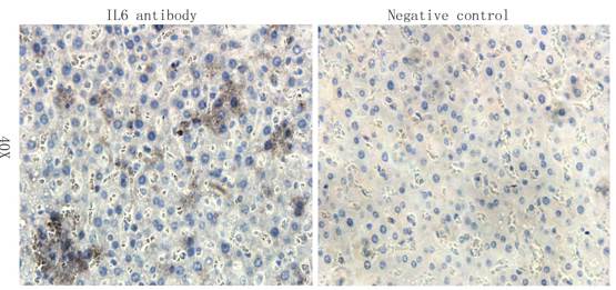 IL6 Rabbit Polyclonal Antibody