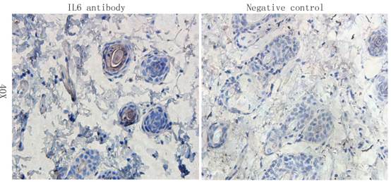 IL6 Rabbit Polyclonal Antibody