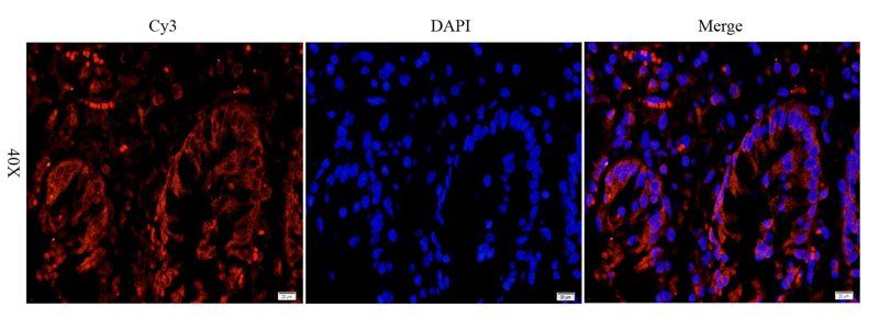 LHCGR Rabbit Polyclonal Antibody