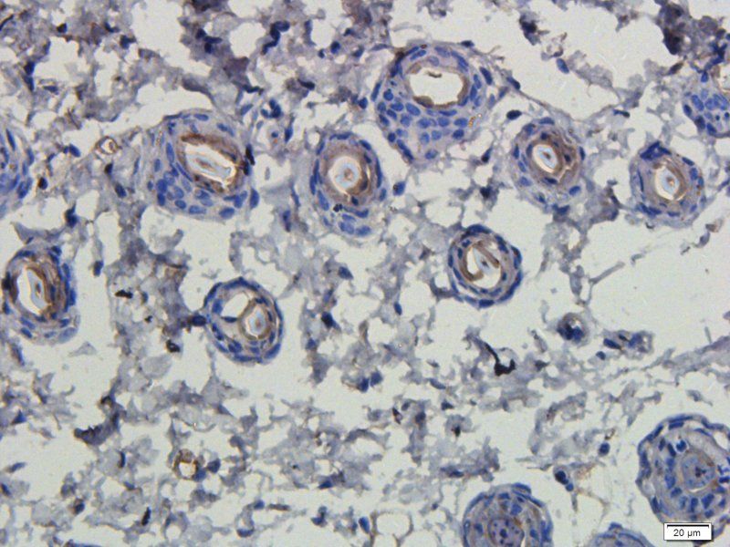 LHCGR Rabbit Polyclonal Antibody