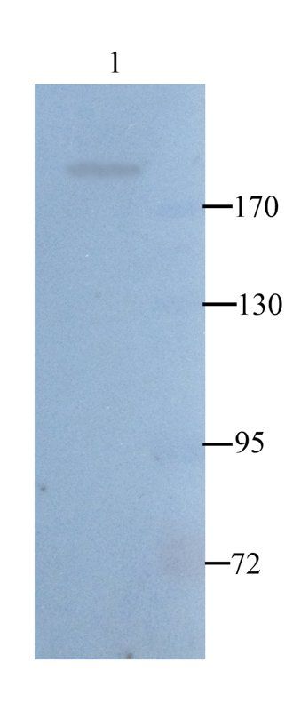 Nestin Rabbit Polyclonal Antibody